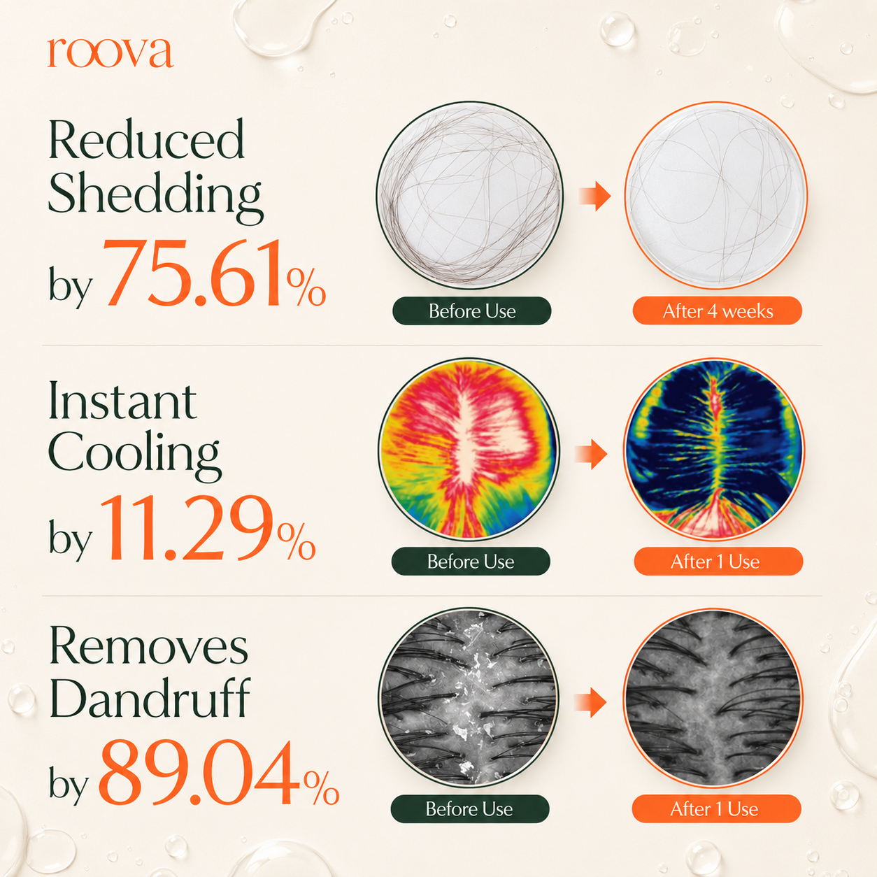 Roova Density